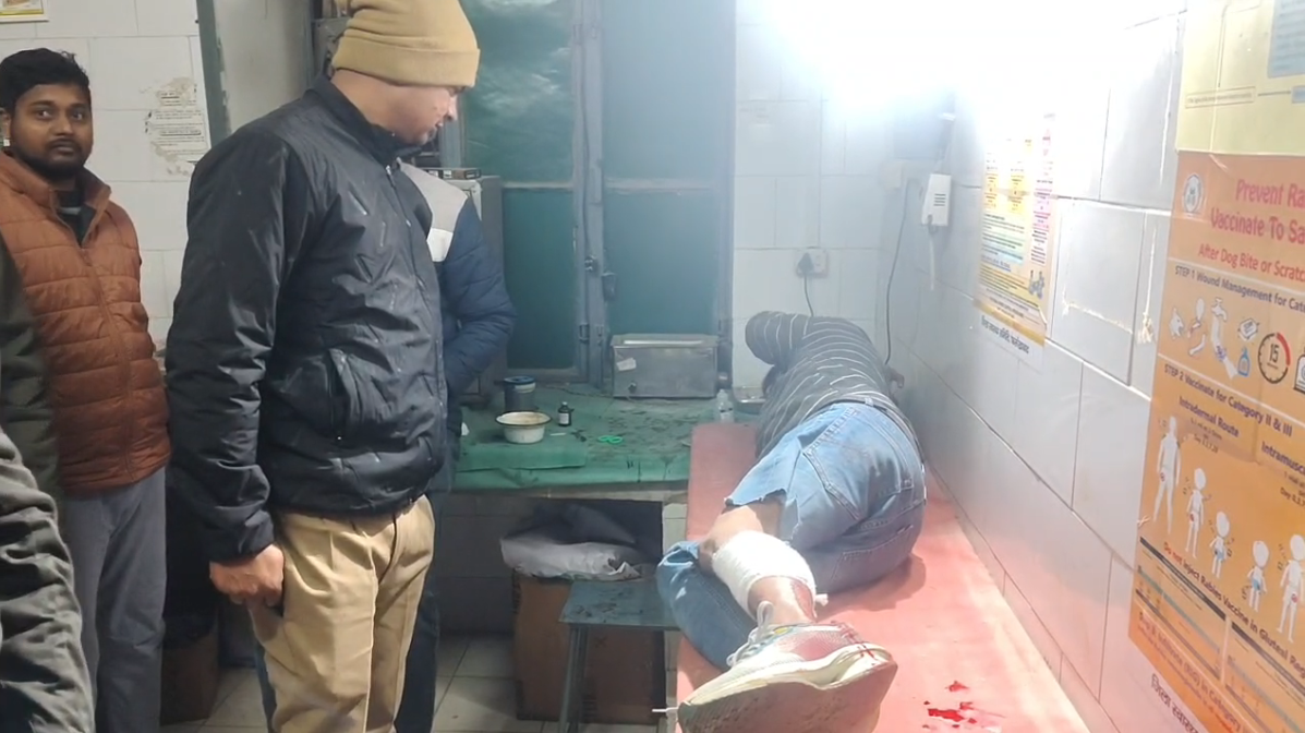 UP NEWS UPDATE :फर्रुखाबाद: 25 हजार के इनामी बदमाश को मुठभेड़ में पुलिस ने दबोचा