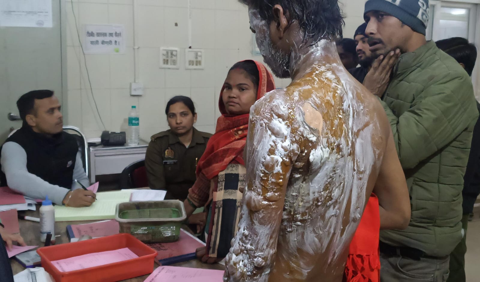 UP NEWS UPDATE :उन्नाव कत्था फैक्ट्री हादसा: गर्म पानी से झुलसा मजदूर शिवकुमार