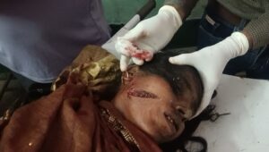 UP NEWS UPDATE :फर्रुखाबाद  में दबंग ने कुल्हाड़ी से महिला पर जानलेवा हमला, राहगीरों ने बचाया और पकड़ा