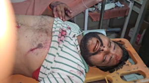 UP NEWS UPDATE :सीतापुर: जमीनी विवाद में बड़े भाई ने छोटे भाई पर चलाई गोली, परिवार में खूनी रंजिश